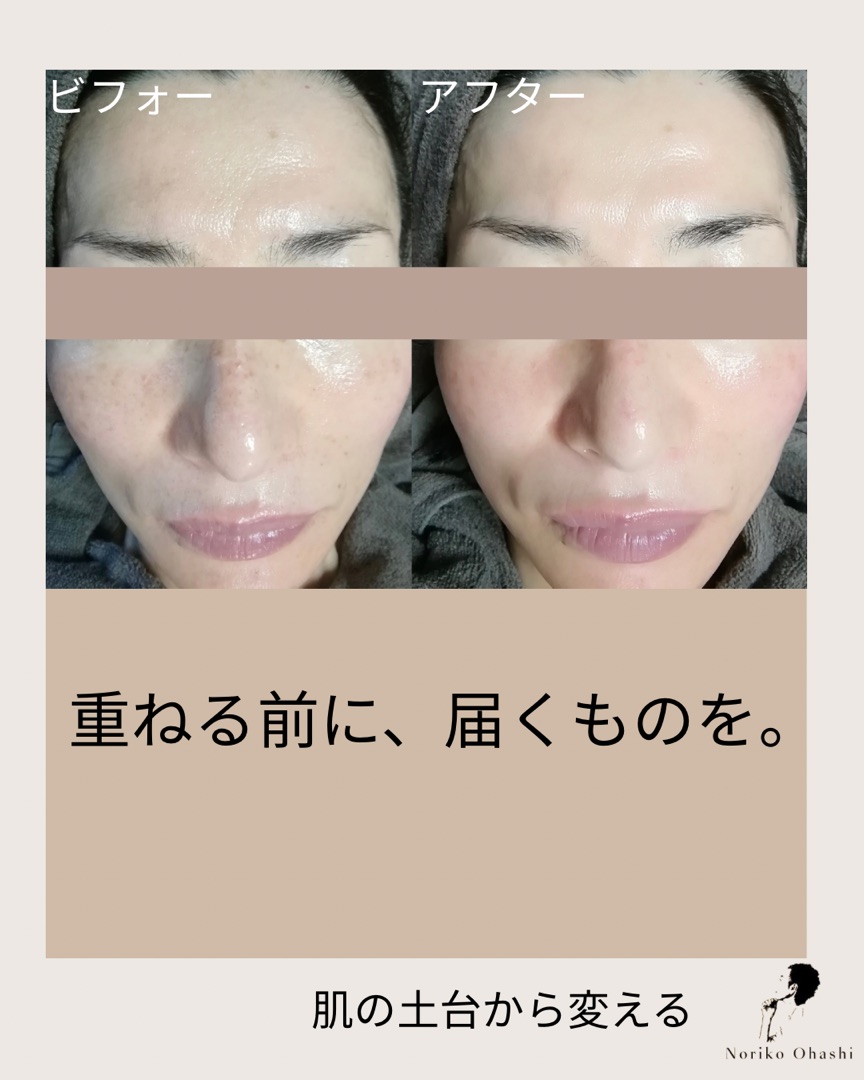 重ねる前に、届くものを。ビフォーアフター